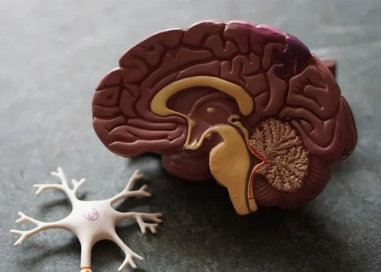 نەخۆشی ئەلزهایمێر|ئاڵزایمێر پشکنین، زانیاری، دەرمان