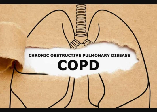 نەخۆشیی COPD چییە؟