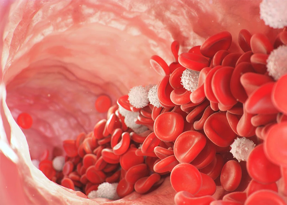 کەمخوێنی چییە؟