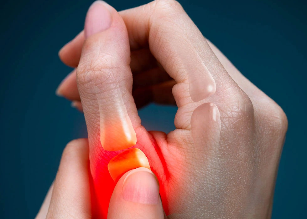 ئارترایتێس