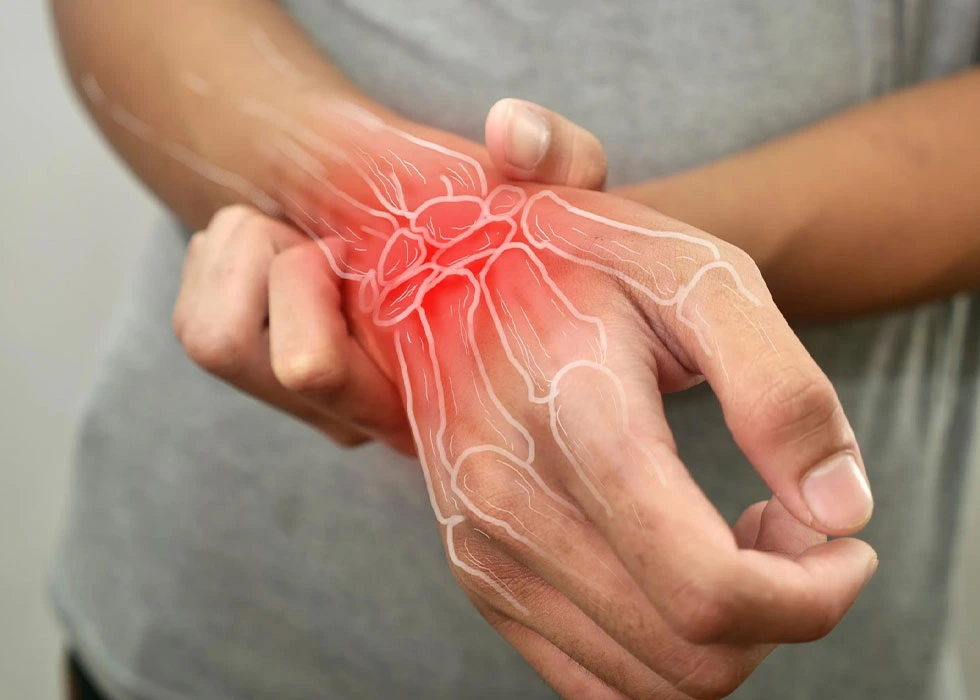 ئارترایتێس