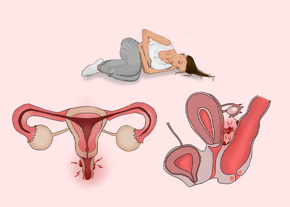 بەشانەبوونی دەرەوەیمنداڵدان