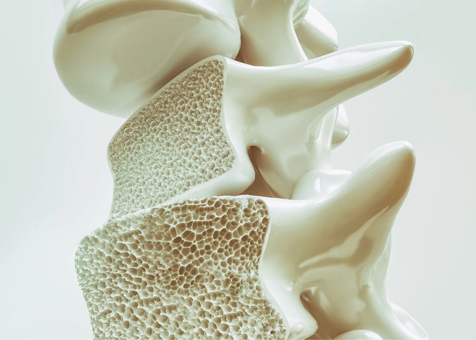 پووکانەوەی ئێسک