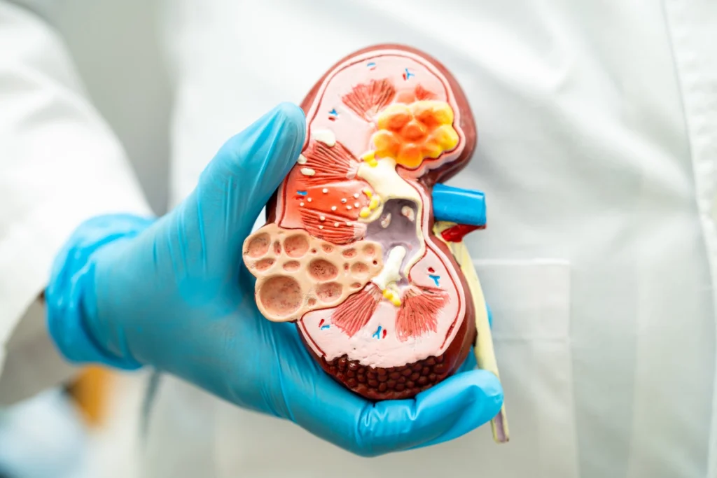 نەخۆشیی درێژخایەنی گورچیلە