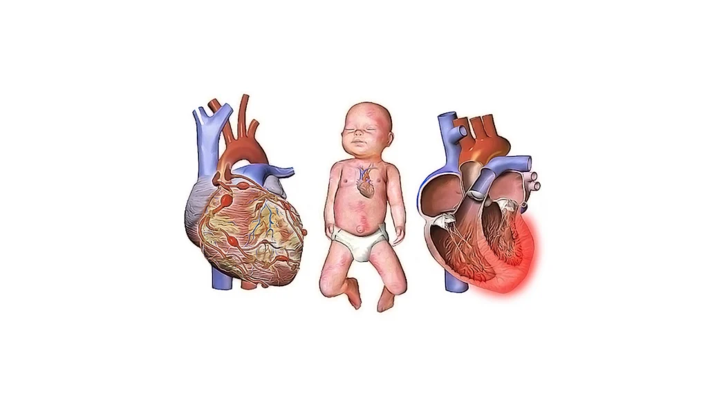 نەخۆشیی کاواساکی